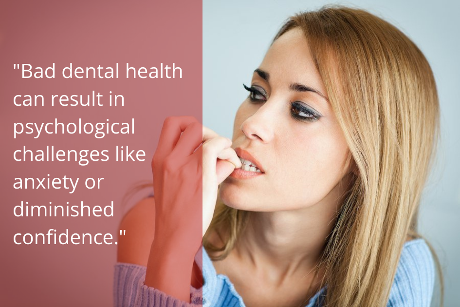 The oral health-mental health connection highlights the impact of bad dental health on psychological challenges.
