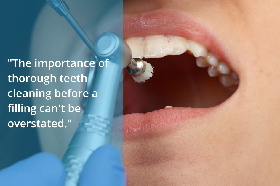 The importance of **cleaning** teeth before **filling** can't be overstated.