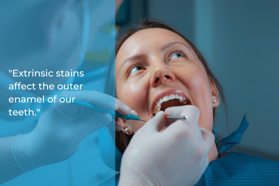 A person sits in a dental chair while the dentist examines their mouth. A translucent overlay mentions how extrinsic stains affect the outer enamel, highlighting the benefits of professional teeth whitening for achieving a radiant smile.