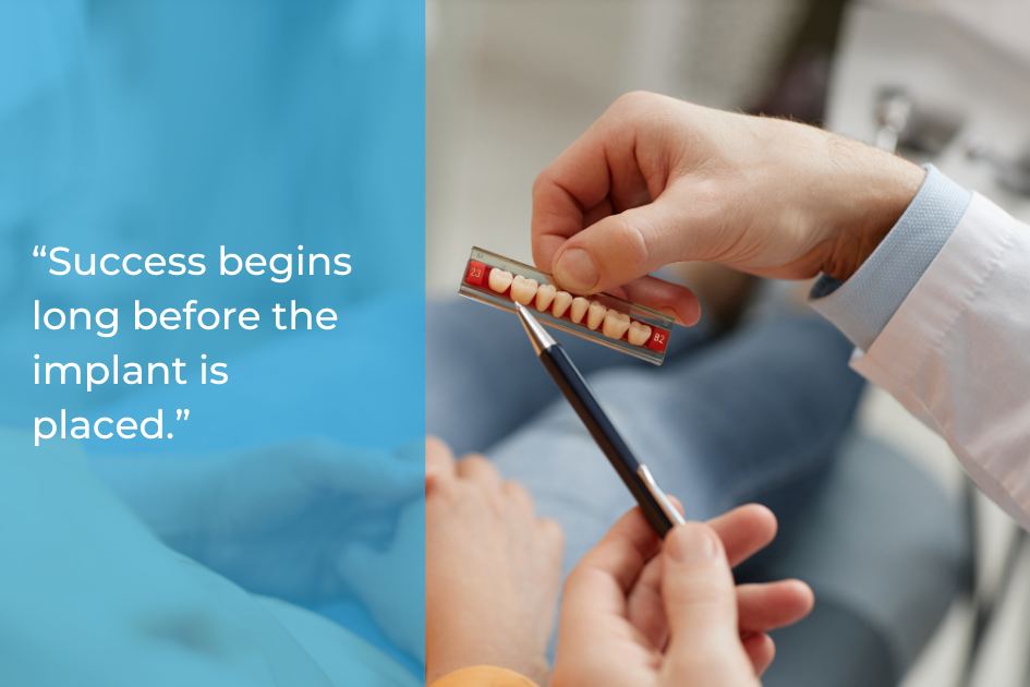 A dentist in Austin holds a dental implant shade guide, showing different tooth colors to a patient. Text on image reads: "Success begins long before the implant is placed.